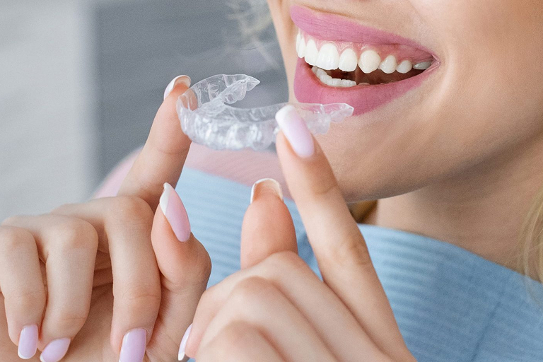 Mobile Banner Invisalign Services